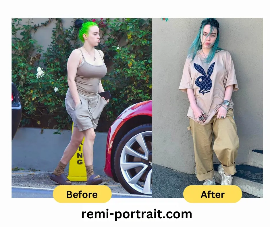 Billie Eilish Weight Loss journey before and after