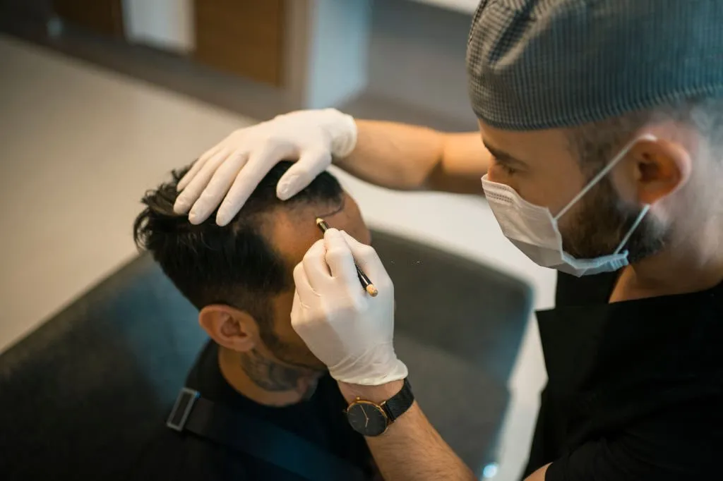 Benefits of a Hair Transplant